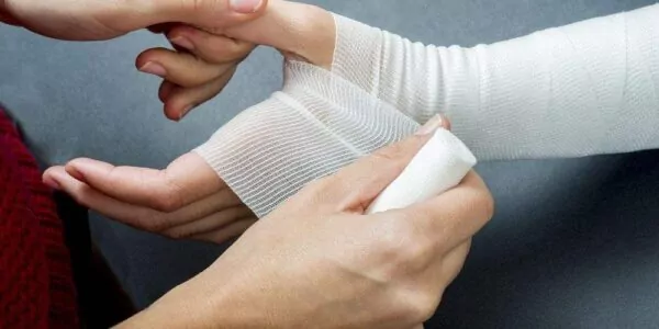 Ouch – That Burns!!