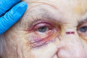 Nursing home abuse can make you lose your trust in the system. Greenwood Nursing Home Abuse and Neglect Lawyer