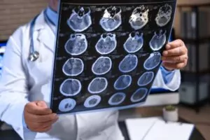 The difference between a concussion and a traumatic brain injury (TBI) is that a TBI is much more serious and affects the victim for longer. What Is the Difference Between a Concussion and a Traumatic Brain Injury?